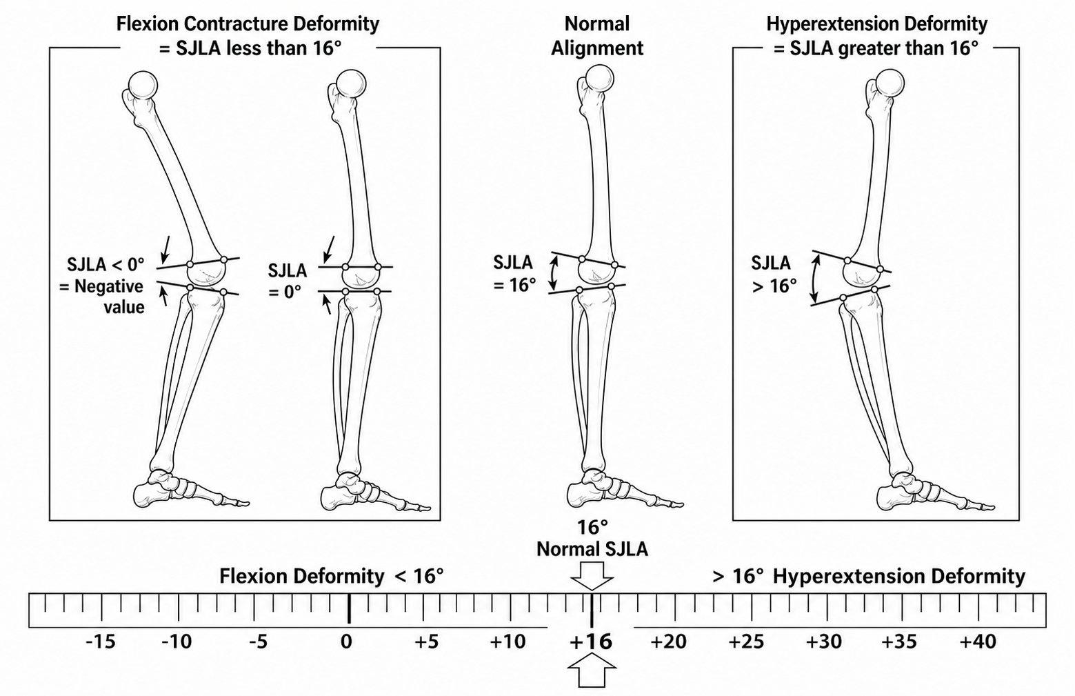 Monochrome sagittal joint line angle drawing