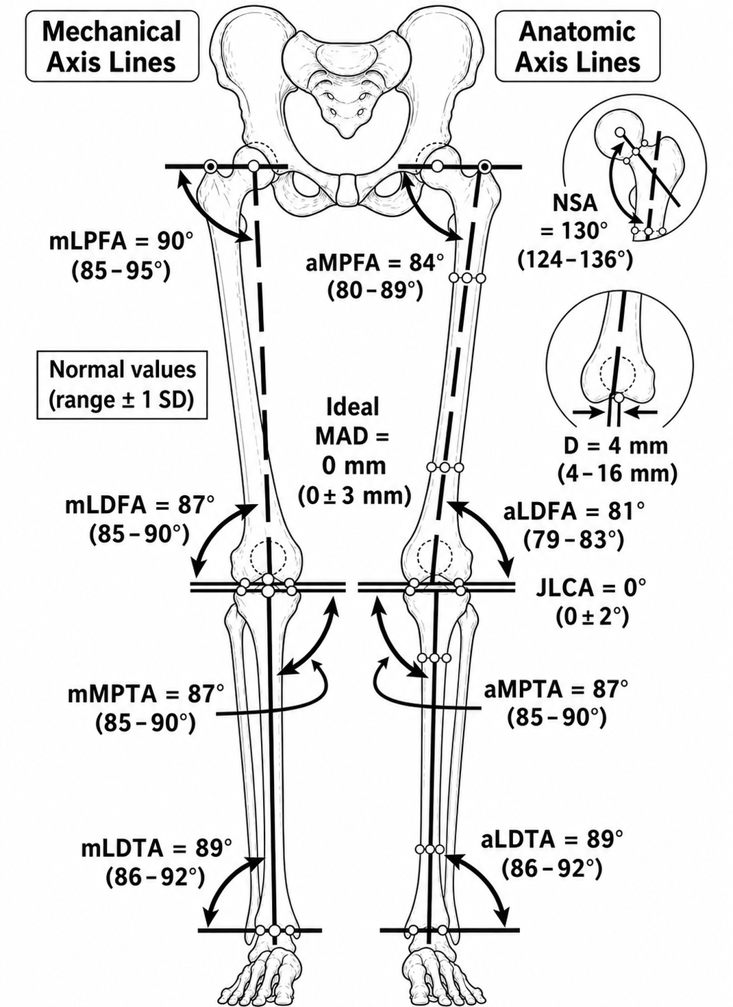 Monochrome frontal-plane lower-limb alignment drawing