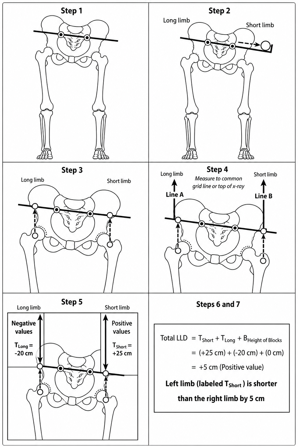 Monochrome MAP the LLD steps using T-short plus 25, T-long minus 20, and total discrepancy 5 cm