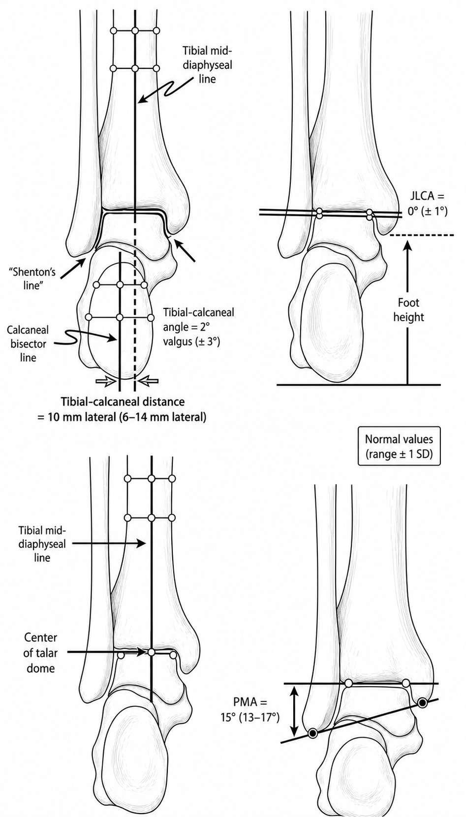 Monochrome ankle AP and axial measurements drawing