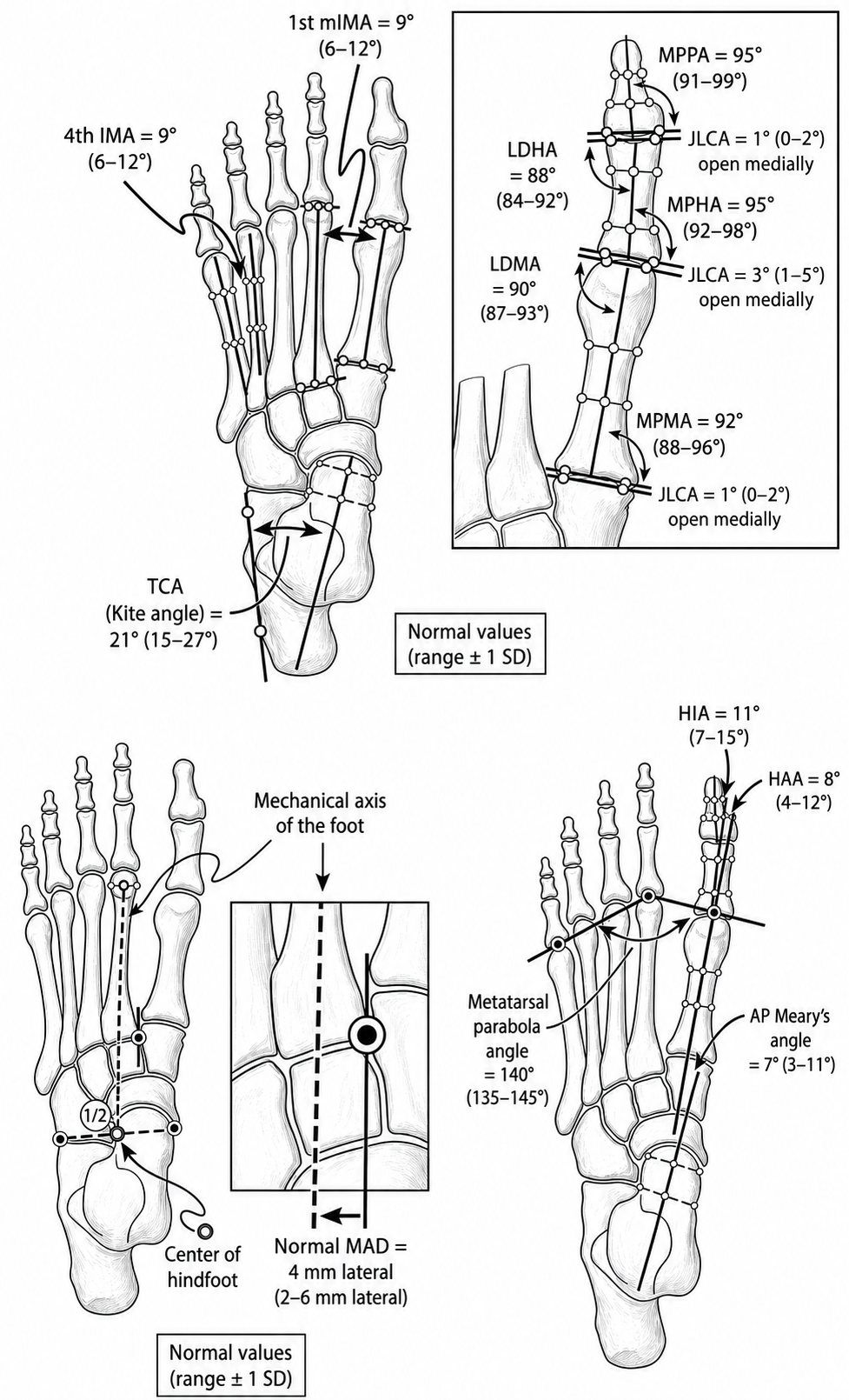 Monochrome AP foot measurements drawing