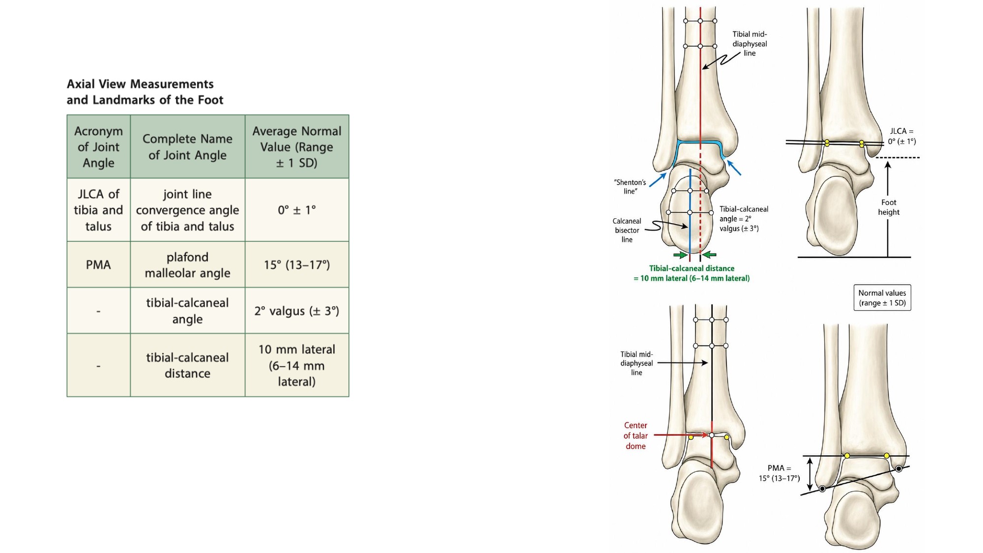 Ankle alignment measurement figures